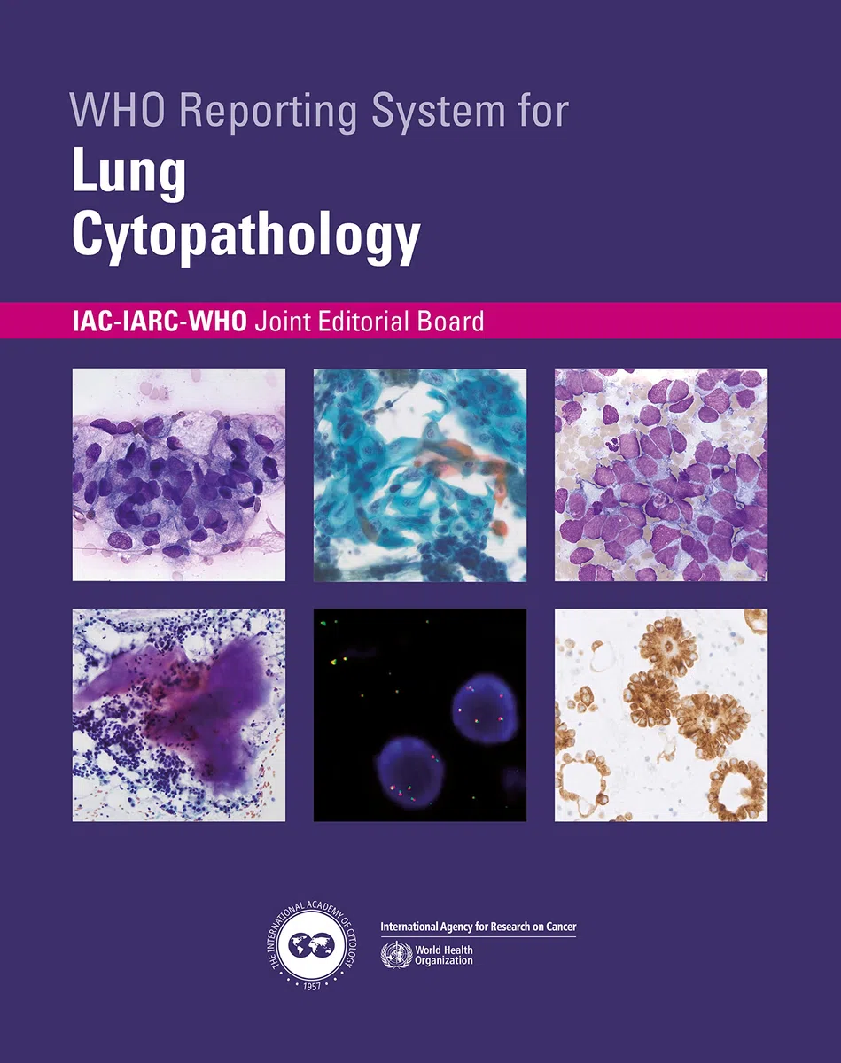 Who Reporting System for Lung Cytopathology: 1