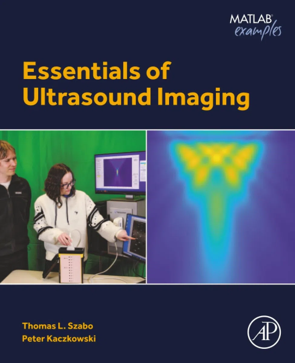 Essentials of Ultrasound Imaging