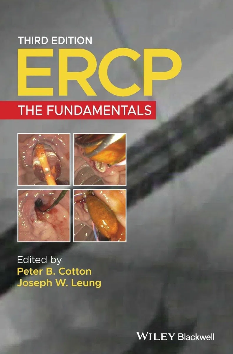 Ercp: The Fundamentals